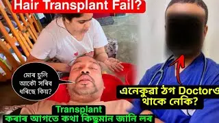 Ripunৰ Hair Transplant Fail? ঠগি আছে কেনেকে Gauhatiত Doctorএ মানুহক | FUE HAIR TRANSPLANT