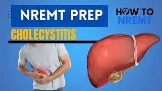 Cholecystitis: Symptoms and Causes