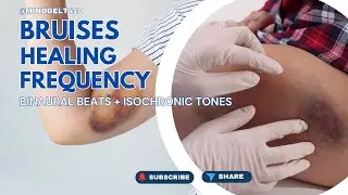 Bruises Rife Frequency Cure | Pure Tone Binaural Beats + Isochronic Tones Healing Sounds