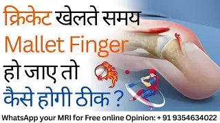 क्रिकेट खेलते समय Mallet Finger हो जाए तो कैसे होगी ठीक ? Mallet Finger in Cricket Injury Treatment