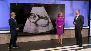 KARK&rsquo;s Laura Monteverdi is going to be a mom!
