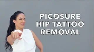 Picosure Tattoo Removal on the Hip | Nazarian Plastic Surgery
