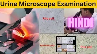 Urine Microscope Examination in Hindi || Urine का स्लाइड कैसे बनते है  || Pus cell, Epithelial cell