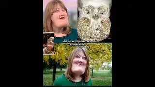 Ella es Victoria Wright y sufre de  Querubismo, mas sobre esta condici&oacute;n gen&eacute;tica en descripci&oacute;n.