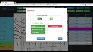 EDF Viewer  settings