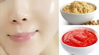 Dark spots on face removal | gram flour for face whitening | how to remove black spots from face
