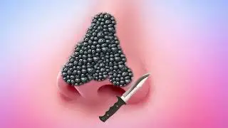 ASMR 2D Animation Treatment of Nose cleaning #asmr