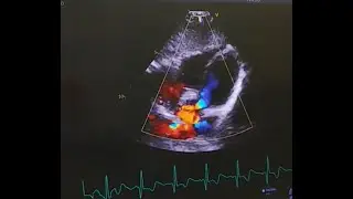 What its Like to be a Cardiologist - Career Day.