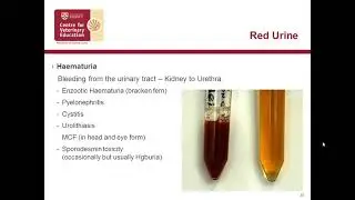 Bovine Anaemia, Jaundice and Red Urine: is it Theileriosis?