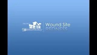 Wound Site Redness