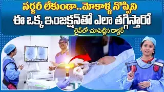 Dr Sudheer Dara About Knee Pain's PRP Treatment LIVE | Epione Hospitals |#sumantvvijayawada