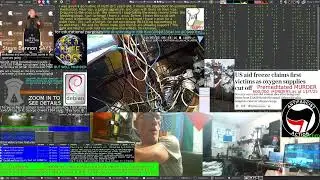 LIVE CAMS of ADHD Schizophrenic No more illegal trade and DRUGS coming soon Music.Suno AI n matt Rap
