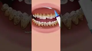 The Ultimate Smile Transformation: Before vs After (Animation) #shorts #asmr #satisfying #teeth
