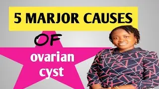 Top 5 Causes Of OVARIAN CYST //Pharmacist Rubby
