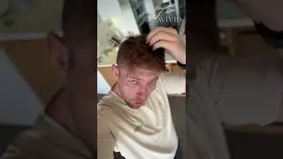 Check this out if you&rsquo;re after a more natural look! | LaVivid Hair System