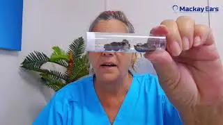 Shocking Ear Wax Removal: Coal Dust Build-Up in a Miner&rsquo;s Ear! #earwaxremoval #mackayears