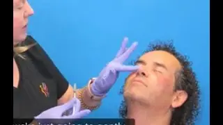 Skin Healing with Exosomes   Dr  Mendelsohn's Secret Weapon for Laser Resurfacing Recovery