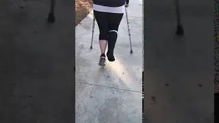 Amy on crutches in a black short leg cast