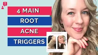 Why am I breaking out? 4 MAIN ROOT ACNE TRIGGERS
