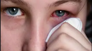 How To Remove Protein Build Up From Contact Lenses