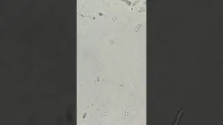 Under the microscope-Candida albicans #shorts #fyp