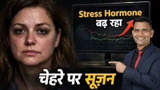 चेहरे पर सूजन आना | cortisol face natural treatment - Dr. Vivek Joshi 