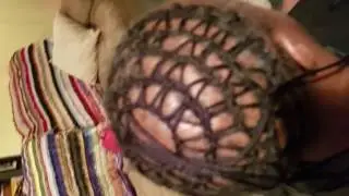 Soft Skull  Hair Restoration