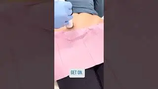 If you&rsquo;ve ever wondered what our non-surgical scar removal treatment looks like, here it is!