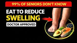 Swollen Legs & Poor Circulation After 60? These Foods Help Fast (Doctor Approved)