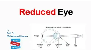 Reduced Eye I  Physiology of Vision (Eye)