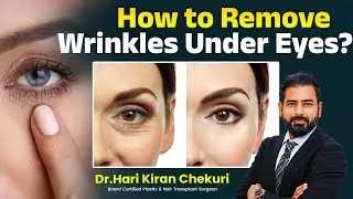 How to Remove Wrinkles Under Eyes || Best Treatment for Wrinkles Under Eyes || ReDefine Channel