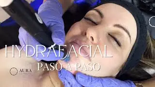 Hydrafacial: El Secreto para una Piel Radiante y Sin Imperfecciones - Beneficios y Resultados