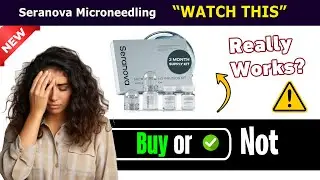 Seranova Microneedling Infusion Kit Review - Does it Really Work? MY Honest Experience