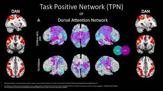 Four Main Brain Networks (Salience, Default Mode, Central Executive, Task Positive)