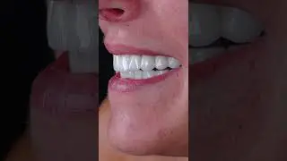 Restore your smile