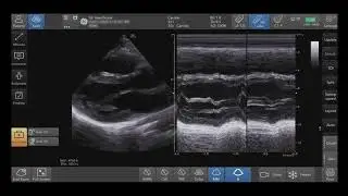 Venue Family Tutorials: Optimizing M-Mode