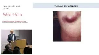 New ways to treat cancer - Adrian Harris Open weeks 2015
