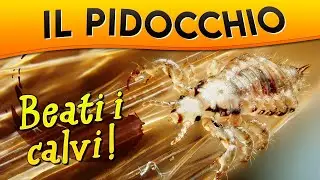 Il Pidocchio: beati i calvi! ► Puntata 45