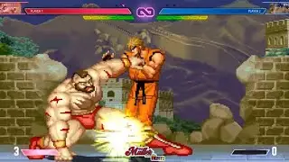 zAnGiEf vs rYo 😱💥 One Mistake Ends It ALL! #StreetFighter #Arcade #EpicBattles