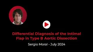 Differential Diagnosis Of The Intimal Flap In Type B Aortic Dissection