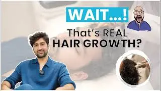 If your hair is thinning, this reel is for you. Watch how hair growth happens.