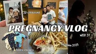 31 неделя беременности | Прием у акушера-гинеколога, 3D УЗИ, рождественские покупки 2025 года, пи...