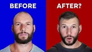 Currentbody Hair Regrowth: Before & After SURPISE?!