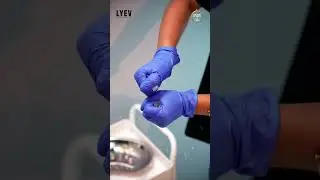 ⏳ Turn Back Time Safely | Anti-Aging Treatments at LYEV Bangladesh ⏳