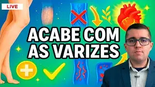 Varizes e trombose: como evitar duas doen&ccedil;as venosas que possuem rela&ccedil;&atilde;o com embolia e m&aacute; circula&ccedil;&atilde;o