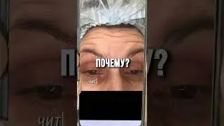 НИКОГДА НЕ ДЕЛАЙТЕ БОТОКС! Это я как врач косметолог вам говорю!  #ботокс #botox
