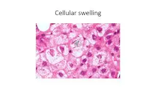 Lecture 2 - Reversible Injury