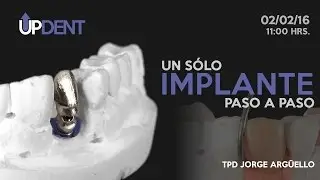 Un sólo Implante. Paso a paso.