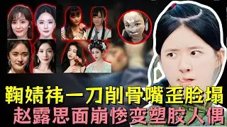 女星一刀削骨翻车太过惊悚，赵露思面崩惨变塑胶人偶，鞠婧祎修修补补嘴歪脸塌，杨紫、杨幂、沈梦辰、金晨、angelababy全部中招#赵露思 #鞠婧祎 #杨幂 #明星 #熱門 ##娱乐评论大赏 #娱乐圈