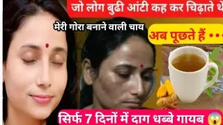 सिर्फ इससे☝️इतने गोरे होगे, पूरा मोहल्ला पूछेगा गोरेपन का राज/ Get Fair,Glowing,Spotless,Tight skin